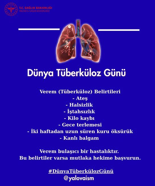 &nbsp; Uzmanlar Verem Belirtilerine